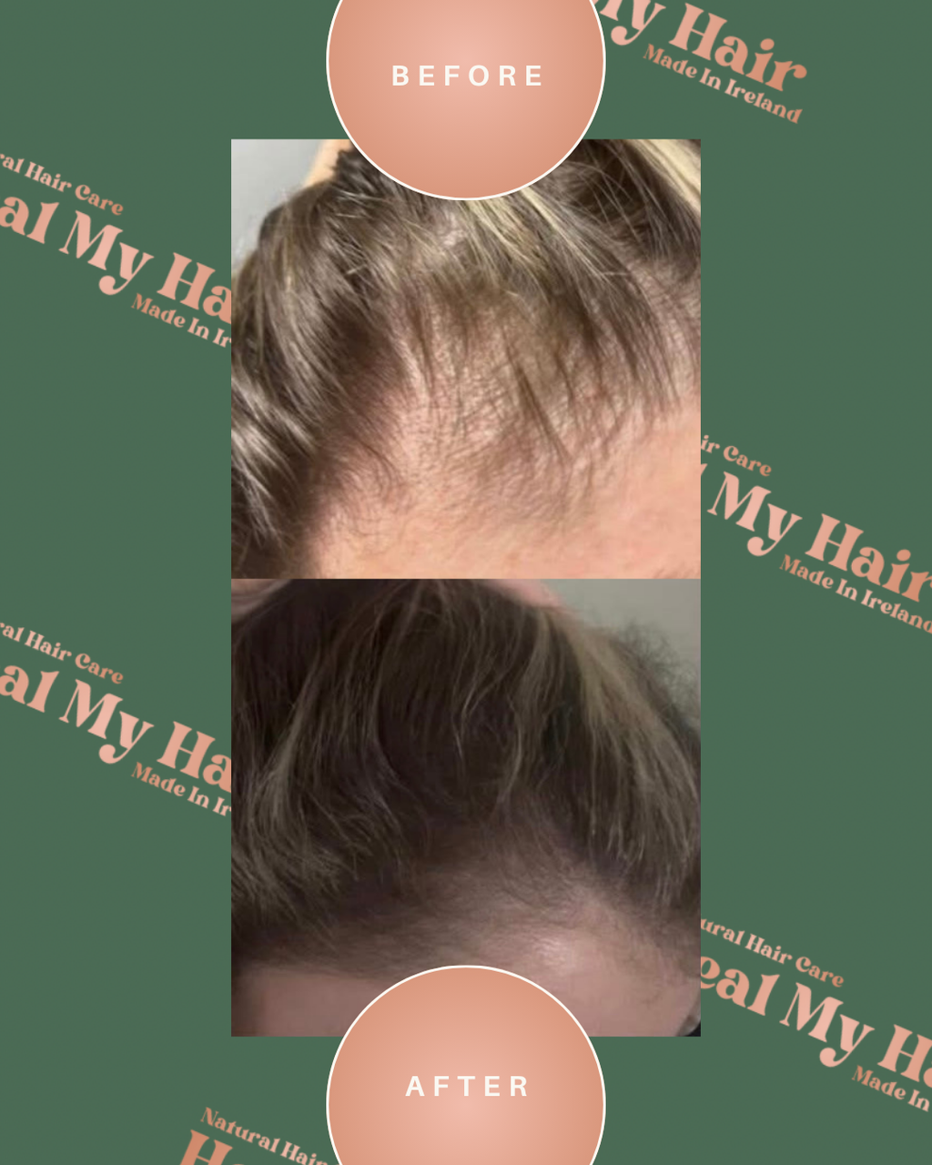 Heal My Hair Oil