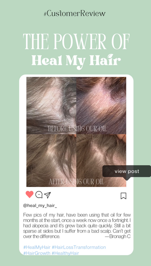 Heal My Hair Oil